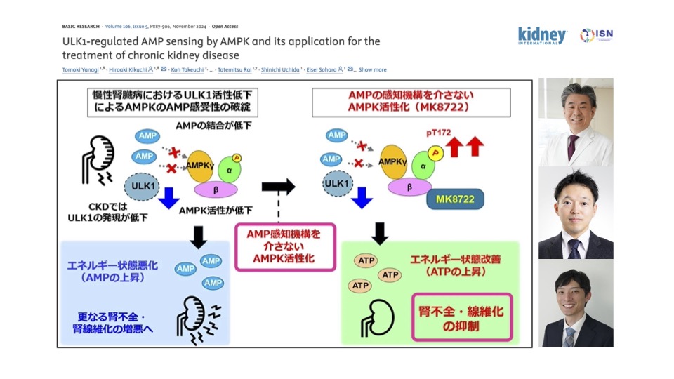 柳智貴 先生, 菊池寛昭 助教らの論文が Kidney International(IF: 14.8)に受理され、プレスリリースされました。